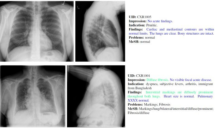 A sample from an x-ray images dataset with annotations