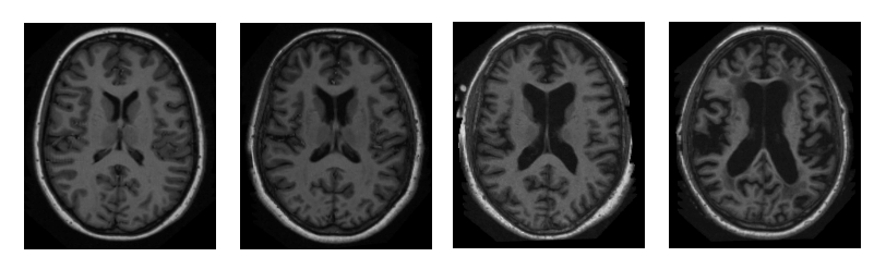 Medical Datasets for Machine Learning